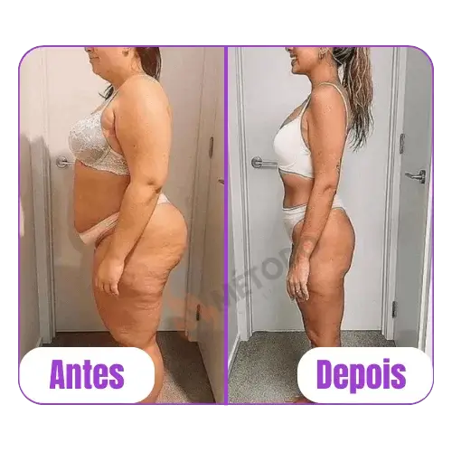 antes-depois-05.webp