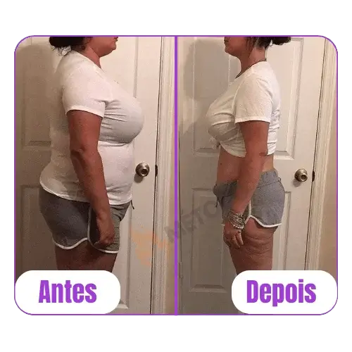 antes-depois-06.webp
